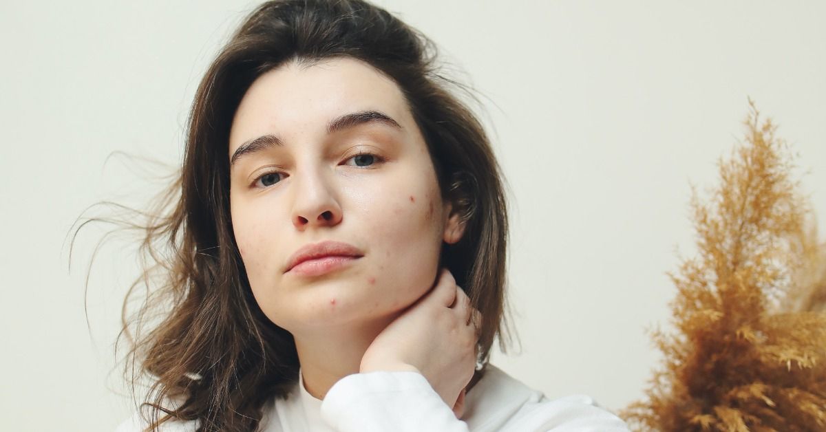 Close up of woman with acne