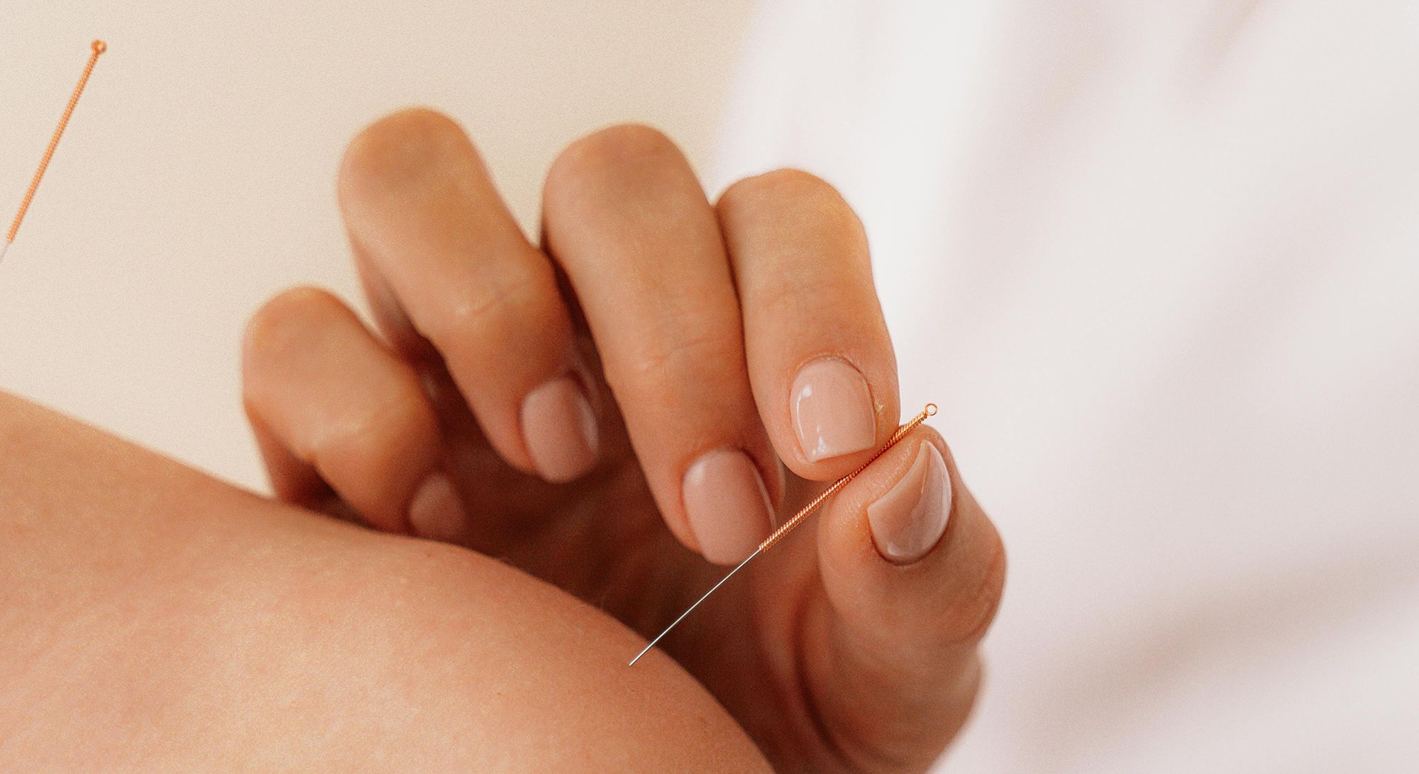 Acupuncture